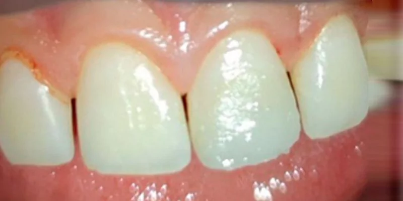 После - Комплексная гигиена